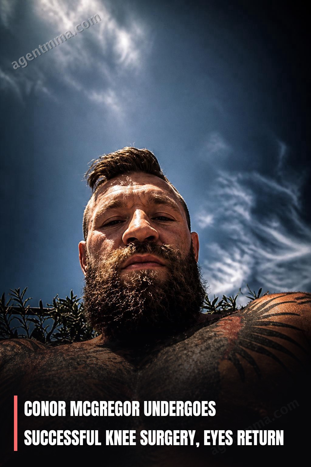 Conor McGregor Undergoes Successful Knee Surgery, Eyes Return
