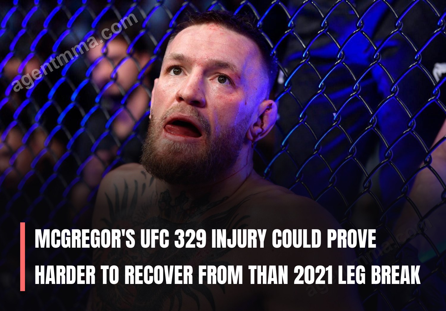 Травма МакГрегора на UFC 329 может оказаться сложнее для восстановления, чем перелом ноги 2021 года