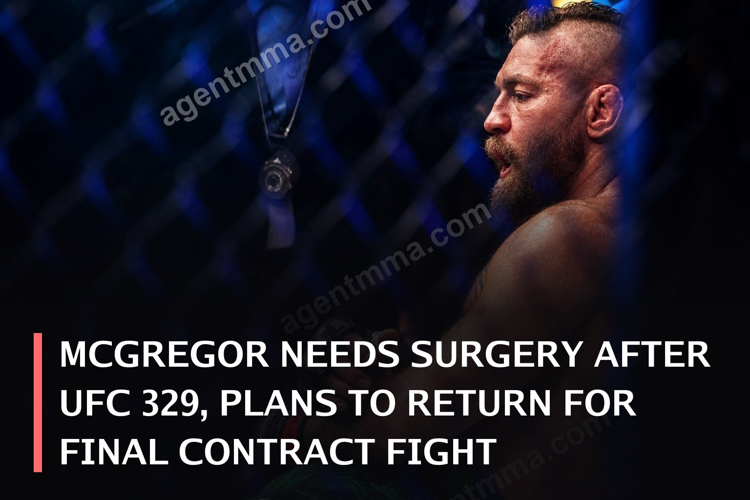McGregor Necesita Cirugía Después de UFC 329, Planea Regresar para su Última Pelea del Contrato