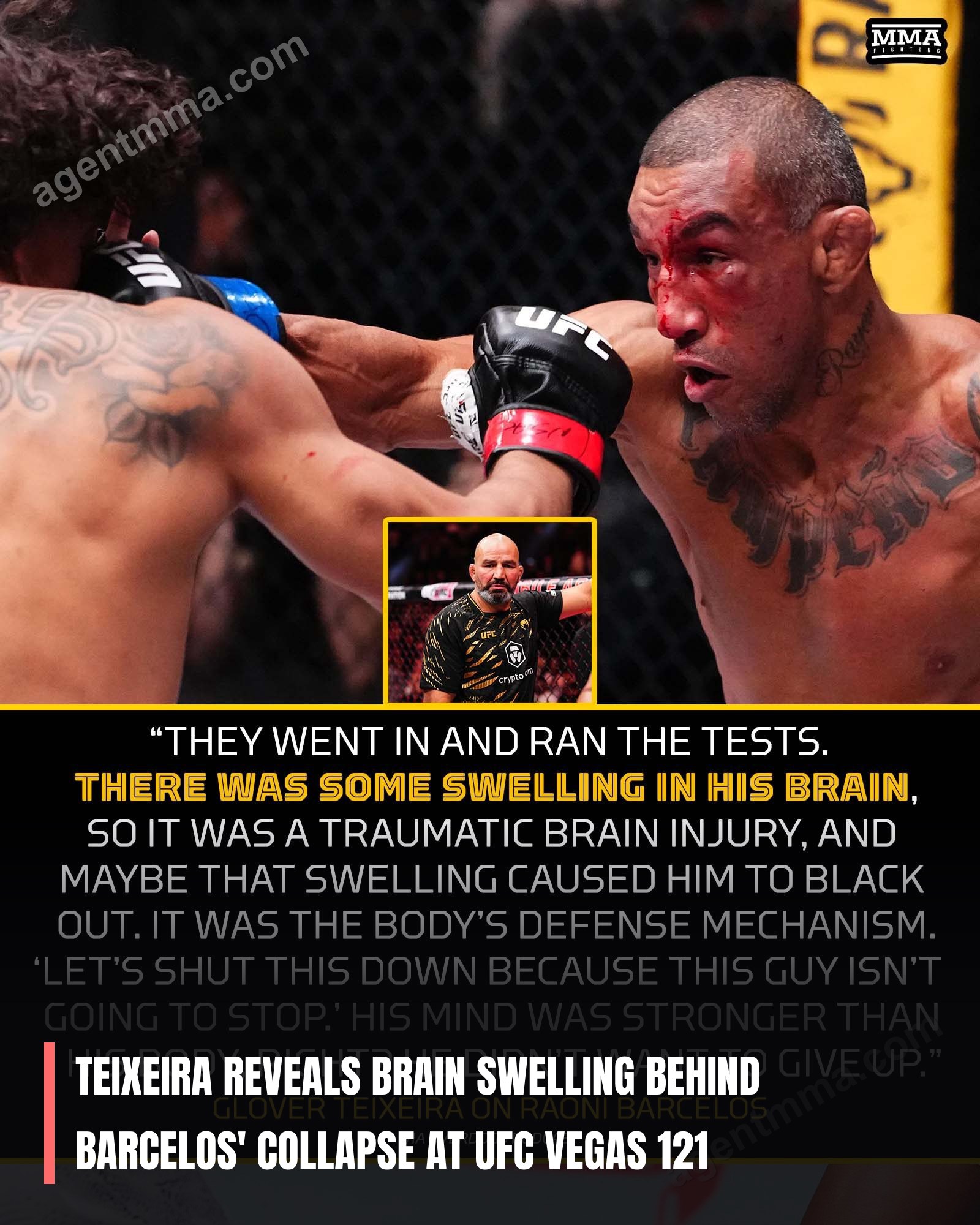 Teixeira reveals brain swelling behind Barcelos' collapse at UFC Vegas 121